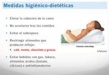 Medidas posturales higienico-dietéticas
