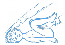 Flexionar las rodillas del niño sobre el abdomen